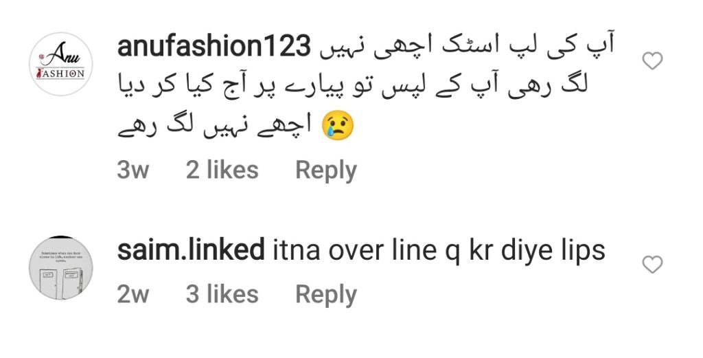 Netizens are not happy with the recently done lip fillers of Nida Yasir